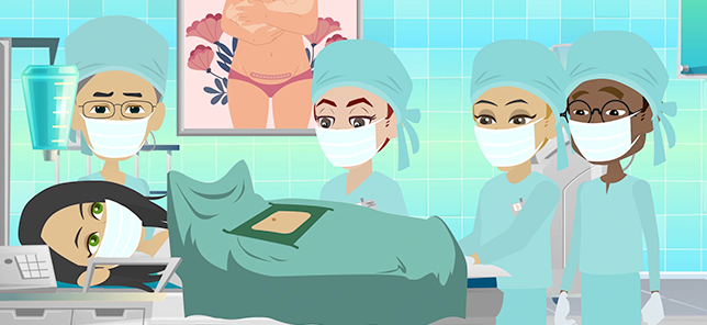 Illustration of cesarean