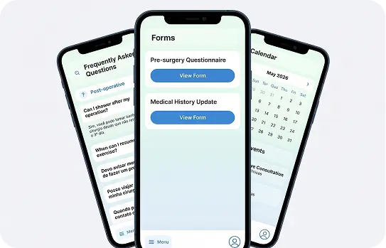 PEEP's forms on smartphones.
